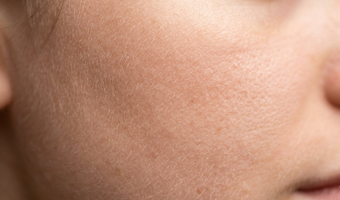 Dermaplaning skin reset — professional exfoliation treatment for smoother, brighter skin with zero downtime